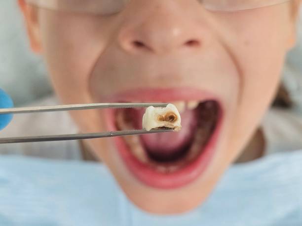 Best 24-Hour Emergency Dental Care in Santa Fe, TX